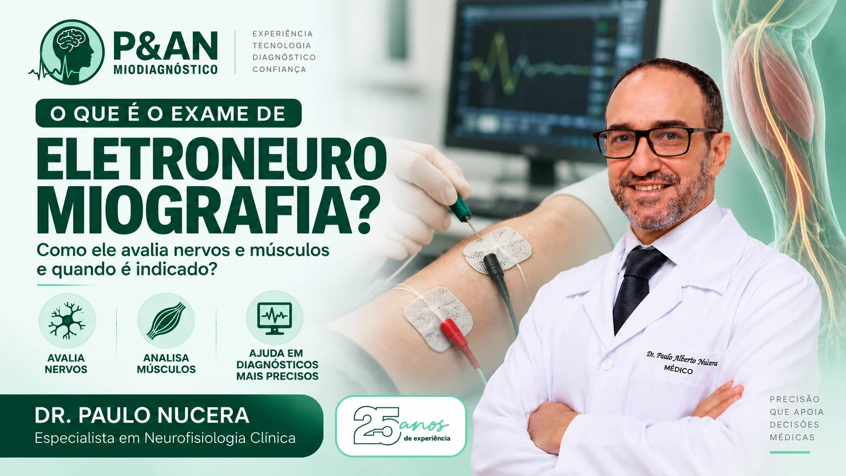 Como é o exame de Eletromiografia?